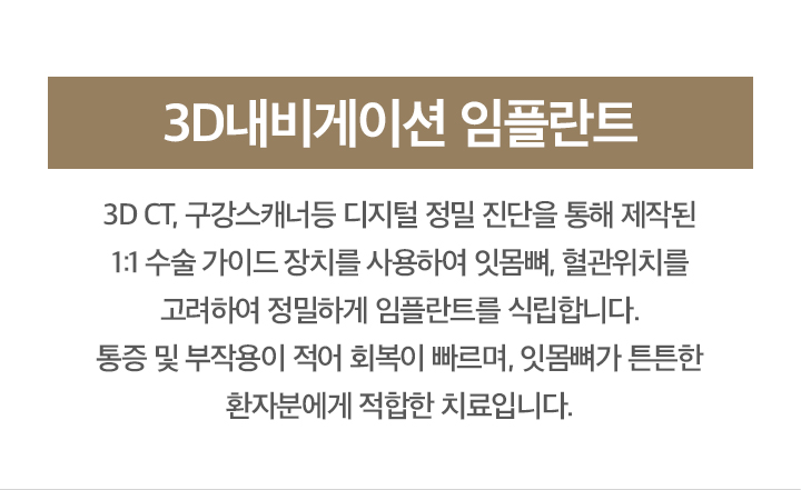 3D내비게이션 임플란트