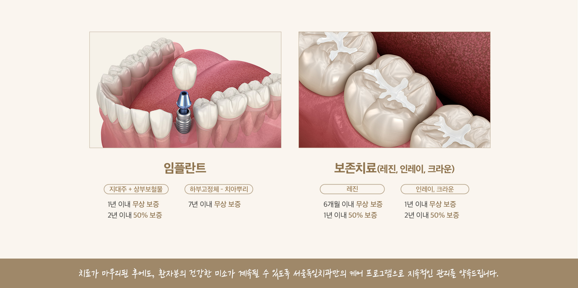 진료보증제도 - 임플란트, 보존치료